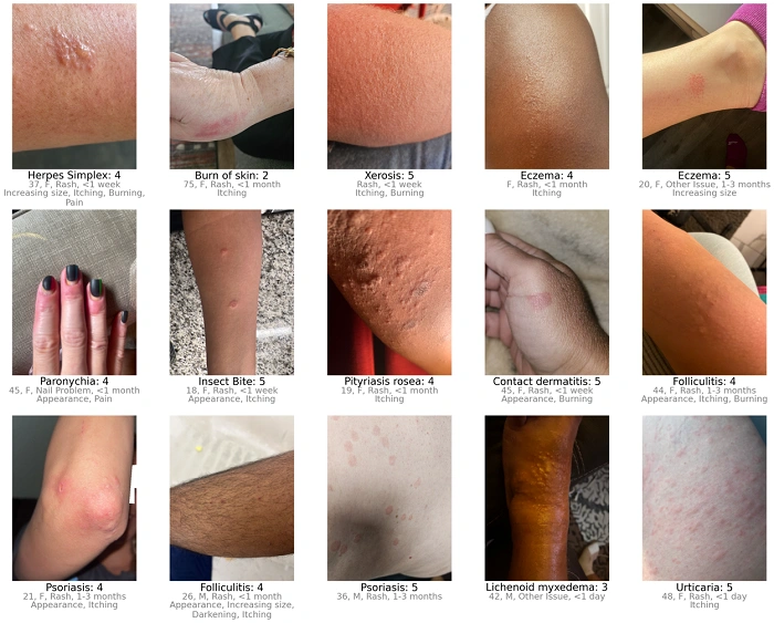 What is the real meaning of Representation in Dermatology